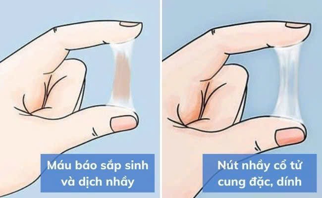 những dấu hiệu sắp sinh